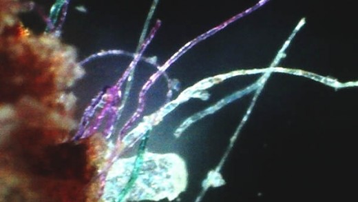 cat_morgellons