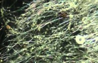 Morgellons und Transhumanismus