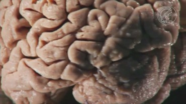 Synaptische Plastizität – wie Synapsen funken