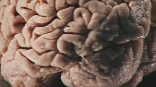 Synaptische Plastizität – wie Synapsen funken